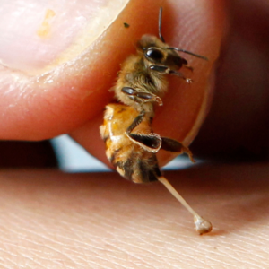 Live Bee Sting Apitherapy